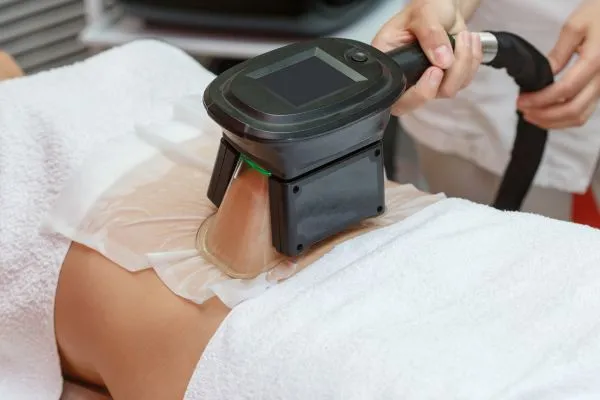 Image of person having fat freezing treatment to help weight gain Princes Risborough