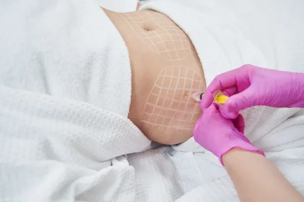 image of fat dissolving injections on love handles to help combat weight gain Princes Risborough
